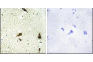 Immunohistochemistry analysis of paraffin-embedded human brain tissue, using CHRC1 Antibody. (CHRAC1 anticorps  (AA 81-130))