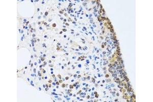 Immunohistochemistry of paraffin-embedded Rat lung using MTA3 Polyclonal Antibody at dilution of 1:100 (40x lens). (MTA3 anticorps)