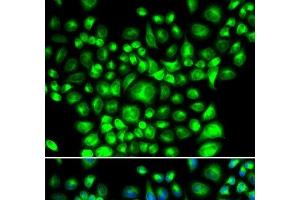 Immunofluorescence analysis of U2OS cells using BCAP31 Polyclonal Antibody (BCAP31 anticorps)