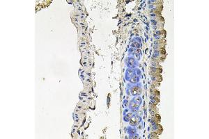 Immunohistochemistry of paraffin-embedded mouse lung using NDUFA6 antibody (ABIN6003563) at dilution of 1/100 (40x lens). (NDUFA6 anticorps)