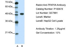 WB Suggested Anti-TFAP2A  Antibody Titration: 1. (TFAP2A anticorps  (C-Term))