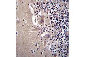 Formalin fixed, paraffin embedded human cerebellum tissue stained with Beta-crystallin A3 Antibody  followed by peroxidase conjugation of the secondary antibody and DAB staining.