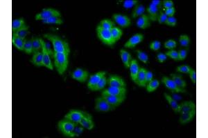 Immunofluorescence staining of HepG2 cells with ABIN7158901 at 1:200, counter-stained with DAPI. (MPP3 anticorps  (AA 301-432))