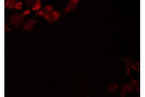 ABIN6274469 staining LOVO by IF/ICC.