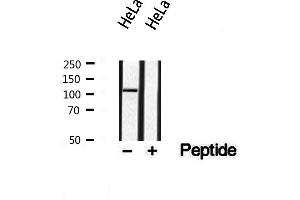 anti-Disabled Homolog 1 (Drosophila) (DAB1) (pTyr220) antibody