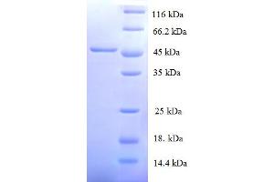SDS-PAGE (SDS) image for Matrix Metallopeptidase 12 (Macrophage Elastase) (MMP12) (AA 109-470), (partial) protein (His tag) (ABIN5709939)