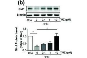 Trimetazidine (TMZ) reduced HFG-induced ROS generation and EMT depending on upregulation of Sirt1. (SIRT1 anticorps  (AA 448-747))