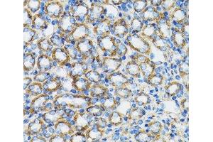 Immunohistochemistry of paraffin-embedded Rat kidney using CTNNA1 Polyclonal Antibody at dilution of 1:100 (40x lens).