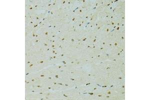 Immunohistochemistry of paraffin-embedded rat heart using RCC1 antibody (ABIN5973761) at dilution of 1/100 (40x lens). (RCC1 anticorps)