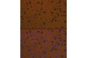 Immunofluorescence analysis of mouse brain cells using Talin 2 Rabbit mAb (ABIN7270720) at dilution of 1:100 (40x lens).