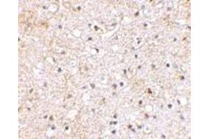 Immunohistochemical staining of human brain tissue using AP30380PU-N Grik1 antibody at 2. (GRIK1 anticorps  (C-Term))