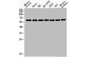 Western blot analysis of mouse-brain HELA KB SH-SY5Y 293T 3T3 Mouse-kidney lysis using GNL3L antibody. (GNL3L anticorps  (Internal Region))