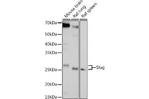 Western blot analysis of extracts of various cell lines, using Slug antibody (ABIN6127298, ABIN6148181, ABIN6148183 and ABIN6217314) at 1:1000 dilution. (SLUG anticorps  (AA 126-268))