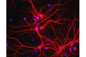 View of mixed neuron/glial cultures stained with MAP2 / MAP-2 antibody (red). (MAP2 anticorps)
