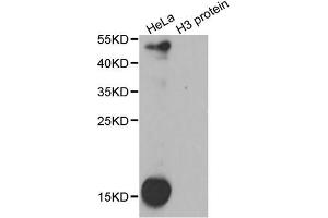anti-Dimethyl-Lysine (methylated) antibody