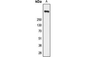 Western blot analysis of Ryanodine Receptor 2 (pS2808) expression in U251 (A) whole cell lysates. (RYR2 anticorps  (pSer2808))