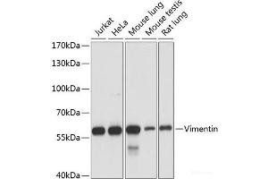 Western blot analysis of extracts of various cell lines using Vimentin Polyclonal Antibody at dilution of 1:1000. (Vimentin anticorps)