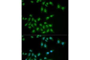 Immunofluorescence analysis of MCF7 cells using HPS1 Polyclonal Antibody (HPS1 anticorps)