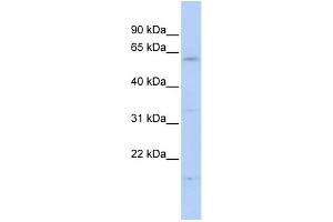 WB Suggested Anti-FBXW11 Antibody Titration:  0. (FBXW11 anticorps  (N-Term))
