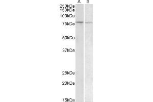 ABIN1590110 (1µg/ml) staining of Human Peripheral Blood Lymphocytes (A) and Human Spleen (B) lysate (35µg protein in RIPA buffer).