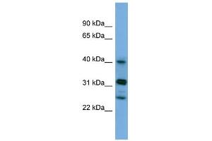 WB Suggested Anti-PPHLN1 Antibody Titration: 0. (PPHLN1 anticorps  (N-Term))