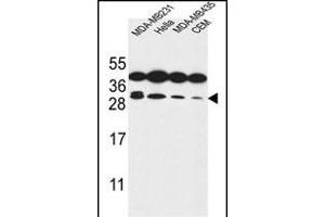 STX10 Antibody (N-term) (ABIN653883 and ABIN2843130) western blot analysis in MDA-M,Hela,MDA-M,CEM cell line lysates (35 μg/lane). (Syntaxin 10 anticorps  (N-Term))