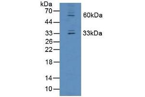 Detection of OIT3 in Mouse Liver Tissue using Polyclonal Antibody to Oncoprotein Induced Transcript 3 (OIT3)