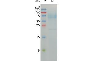 Selenoprotein P (SELENOP) (AA 1-381) protein (DYKDDDDK Tag)