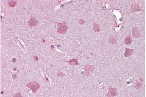 Immunohistochemistry with Brain, cortex tissue at an antibody concentration of 5µg/ml using anti-NDP antibody (ARP56082_P050) (Norrie Disease (Pseudoglioma) anticorps  (Middle Region))