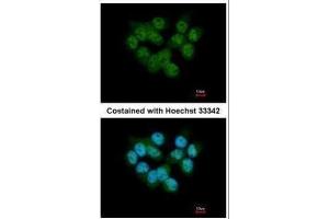 ICC/IF Image Immunofluorescence analysis of paraformaldehyde-fixed A431, using SEPHS2, antibody at 1:500 dilution.