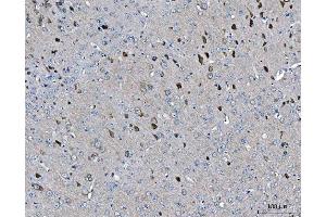 IHC analysis of ARFGAP1 using anti-ARFGAP1 antibody (ABIN4886474). (ARFGAP1 anticorps  (AA 1-183))