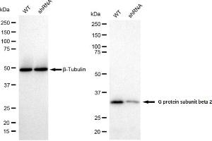 Western blotting analysis using G protein subunit beta 2 antibody (ABIN7798822).