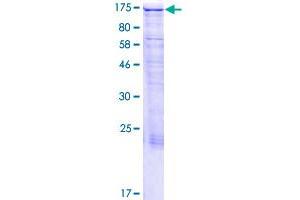 Image no. 1 for Microtubule-Associated Protein 1S (MAP1S) (AA 1-1059) protein (GST tag) (ABIN1310162)