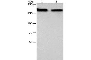 Western Blot analysis of 293T and hela cell using NCAPD2 Polyclonal Antibody at dilution of 1:425 (NCAPD2 anticorps)