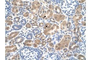 SLC38A1 antibody was used for immunohistochemistry at a concentration of 4-8 ug/ml to stain Epithelial cells of renal tubule (arrows) in Human Kidney. (SLC38A1 anticorps  (Middle Region))