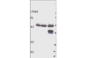 Western blot using  Affinity Purified anti-p44 MAP Kinase (ERK1) antibody shows detection of ERK1 in whole cell lysates prepared from mouse brain (left), mouse kidney (center) and mouse intestine (right). (ERK1 anticorps  (C-Term))