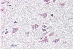 Anti-GOLGA6 antibody IHC staining of human brain, cortex. (GOLGA6A anticorps  (AA 536-547))