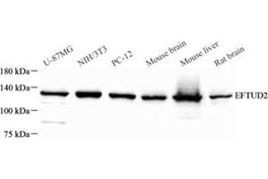 Western blot analysis of EFTUD2 (ABIN7073810) at dilution of 1: 500 (EFTUD2 anticorps)