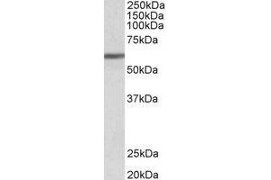 Western Blotting (WB) image for anti-Zinc Finger Protein 703 (ZNF703) (Internal Region) antibody (ABIN2466469) (ZNF703 anticorps  (Internal Region))