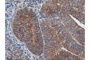 Image no. 7 for anti-IlvB (Bacterial Acetolactate Synthase)-Like (ILVBL) antibody (ABIN1498878) (ILVBL anticorps)