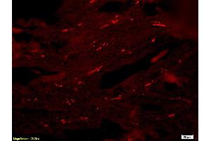 Formalin-fixed and paraffin-embedded : rat breast tissue labeled with Rabbit Anti-Reprimo Polyclonal Antibody (ABIN735863), Unconjugated 1:200 followed by conjugation to the secondary PE antibody