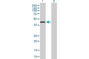 Western Blot analysis of ZNF302 expression in transfected 293T cell line by ZNF302 MaxPab polyclonal antibody. (ZNF302 anticorps  (AA 1-399))