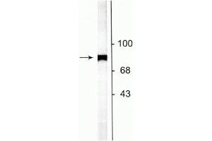 Western blot of rat striatal lysate showing specific labeling of the ~75 kDa NSF protein.
