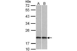 WB Image Sample (30 ug of whole cell lysate) A: H1299 B: Molt-4 , 12% SDS PAGE antibody diluted at 1:1000 (Cofilin 2 anticorps)