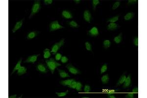Immunofluorescence of monoclonal antibody to IRAK1 on HeLa cell.