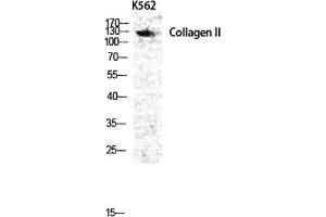 Western Blot analysis of various cells using COL2A1 Polyclonal Antibody diluted at 1:1000. (COL2A1 anticorps  (AA 70-150))