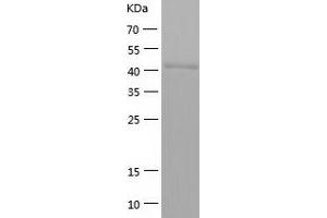 Western Blotting (WB) image for Acetyl-CoA Acetyltransferase 1 (ACAT1) (AA 34-427) protein (His-IF2DI Tag) (ABIN7121640)