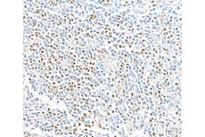 Immunohistochemistry (IHC) image for anti-Transcription Factor 7 (T-Cell Specific, HMG-Box) (TCF7) (AA 200-250) antibody (ABIN7449420) (Recombinant TCF7 anticorps  (AA 200-250))