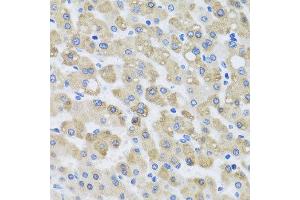 Immunohistochemistry of paraffin-embedded human liver injury using SNAP29 antibody at dilution of 1:100 (x40 lens). (SNAP29 anticorps)