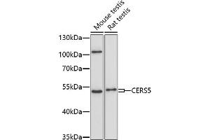 Western blot analysis of extracts of various cell lines, using CERS5 antibody (ABIN7268175) at 1:1000 dilution. (LASS5 anticorps  (AA 1-100))